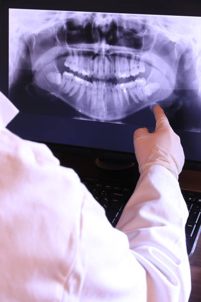 Best Emergency Root Canal Therapy in Cedar Point, NC