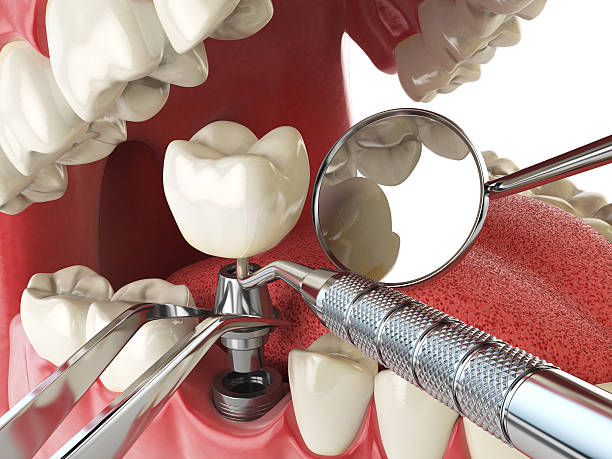 Best Emergency Root Canal Therapy in Cedar Point, NC